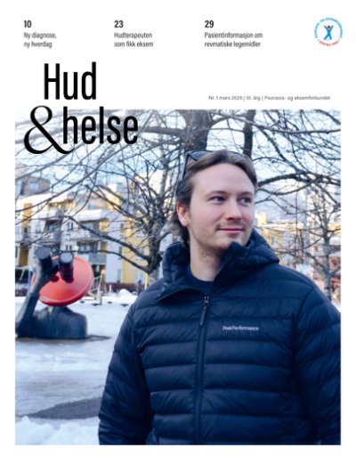 Bilde: Å være nydiagnostisert