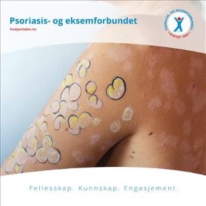 Bilde: Informasjonsmateriell